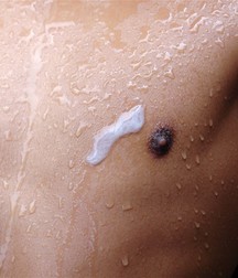 Chemo 5936d8b862bfb.jpg
