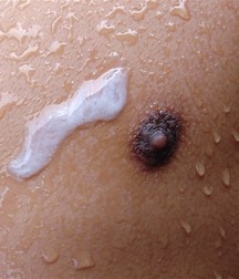 Chemo 5936d8ba58bde.jpg