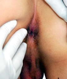 RAFAEL MEDICAL 57e37cf0cf478.jpg