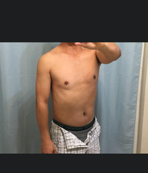 Hot1 58bfbb6039962.png