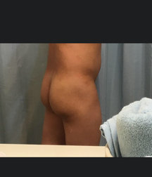 Hot1 58bfbb6290270.png