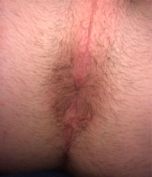 Hot1 58bfbb6a648a0.png