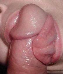 Penis A 57e6fd440f3d4.jpg