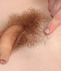 Penis A 57e6fd4b38d02.jpg