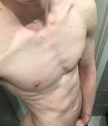 Gay Lithuanian Model 5c816a0c3ddea.png