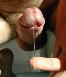 Outfti-Sperm 5e6948966eecf.jpg