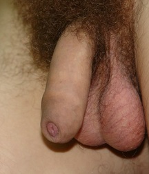 uncut guys 5922af2c07533.jpg