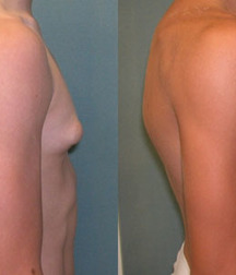 Puffy teen bitchtits medical fetish 577aca452c849.jpg