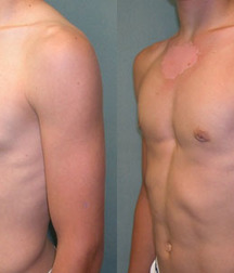 Puffy teen bitchtits medical fetish 577aca4609246.jpg