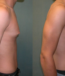 Puffy teen bitchtits medical fetish 577aca46d9ace.jpg