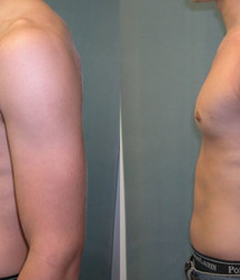 Puffy teen bitchtits medical fetish 577aca48ae64c.jpg