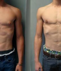 Puffy teen bitchtits medical fetish 577aca4a9ebcd.jpg