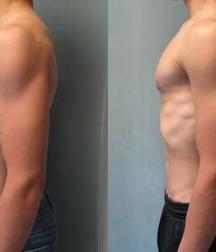 Puffy teen bitchtits medical fetish 577aca4be68c1.jpg