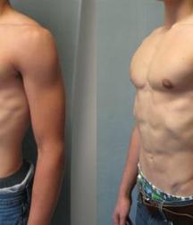 Puffy teen bitchtits medical fetish 577aca4cd7eb1.jpg