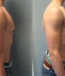 Puffy teen bitchtits medical fetish 577aca4d8d9df.jpg