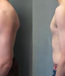 Puffy teen bitchtits medical fetish 577aca508174a.jpg