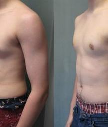 Puffy teen bitchtits medical fetish 577aca5142360.jpg