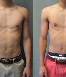 Puffy teen bitchtits medical fetish 577aca51d9ed3.jpg