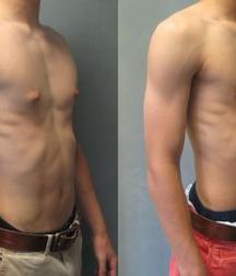 Puffy teen bitchtits medical fetish 577aca52a0a90.jpg