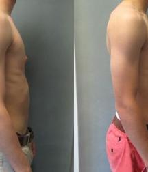 Puffy teen bitchtits medical fetish 577aca5347e89.jpg