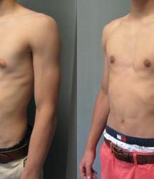 Puffy teen bitchtits medical fetish 577aca540a8f8.jpg