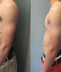 Puffy teen bitchtits medical fetish 577aca54b1c6d.jpg