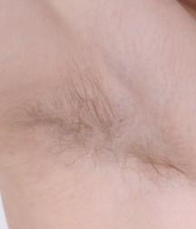 Armpits 5e9ccb3bec55e.jpg
