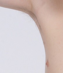 Armpits 5e9ccb405a98a.jpg
