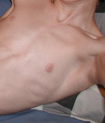 Shaved pits 59954ce22484a.jpg