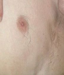 Boys hairy chest 599b0edb84651.jpg
