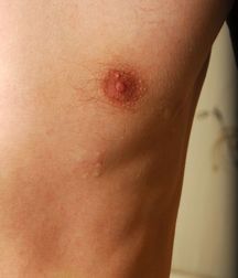 Boys hairy chest 599b0ef979c22.jpg