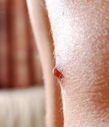 Boys hairy chest 599b0f0948bc7.jpg