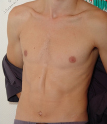 Boys hairy chest 599b0f10ea397.jpg