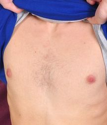 Boys hairy chest 599b0f21b3c33.jpg