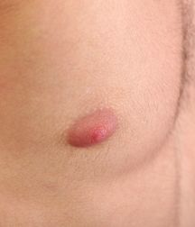 Boys hairy chest 599b0f240f814.jpg