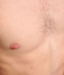 Boys hairy chest 599b0f254edb1.jpg