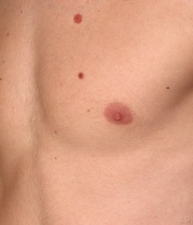 Boys hairy chest 599b0f414b577.jpg