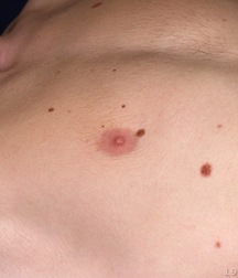 Boys hairy chest 599b0f43ba9b9.jpg