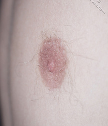 Boys hairy chest 599b0f69b0adb.jpg