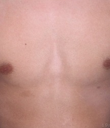 Boys hairy chest 599b0f7b96323.jpg