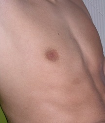 Boys hairy chest 599b0f7df0a8f.jpg