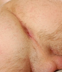 Bryan shaved cock hairy legs 599bfadea6650.jpg