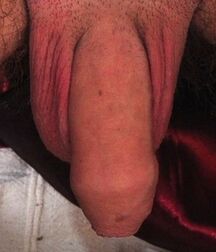 Gay tube Ivo twinks porn 5f0d75ee82efd.jpg