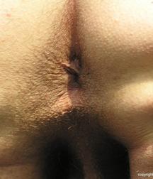 Adam 59ef5490e1f16.jpg