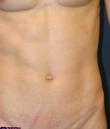 ERICK 5a2ba6d715dbe.jpg