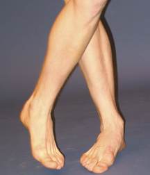 ERICK 5a2ba70904f42.jpg