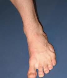 ERICK 5a2ba710c45e4.jpg