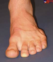 ERICK 5a2ba714b7fa9.jpg