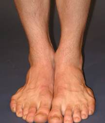 ERICK 5a2ba71806f3f.jpg