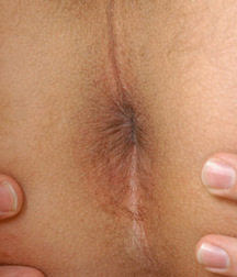 Bronson 5a339cb2ef5f8.jpg